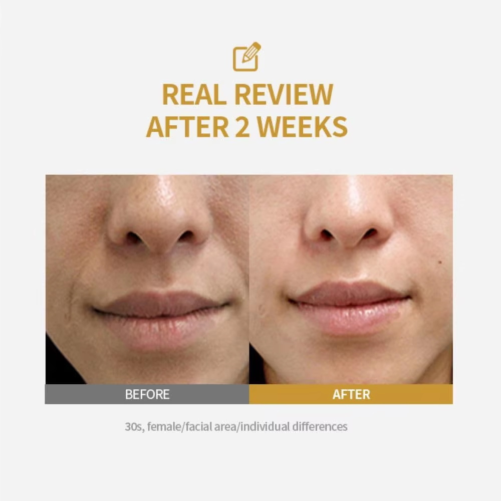 Peptid-Intensiv-Lifting-Ampull – Luxury Skincare Brands Bewertung und Preis