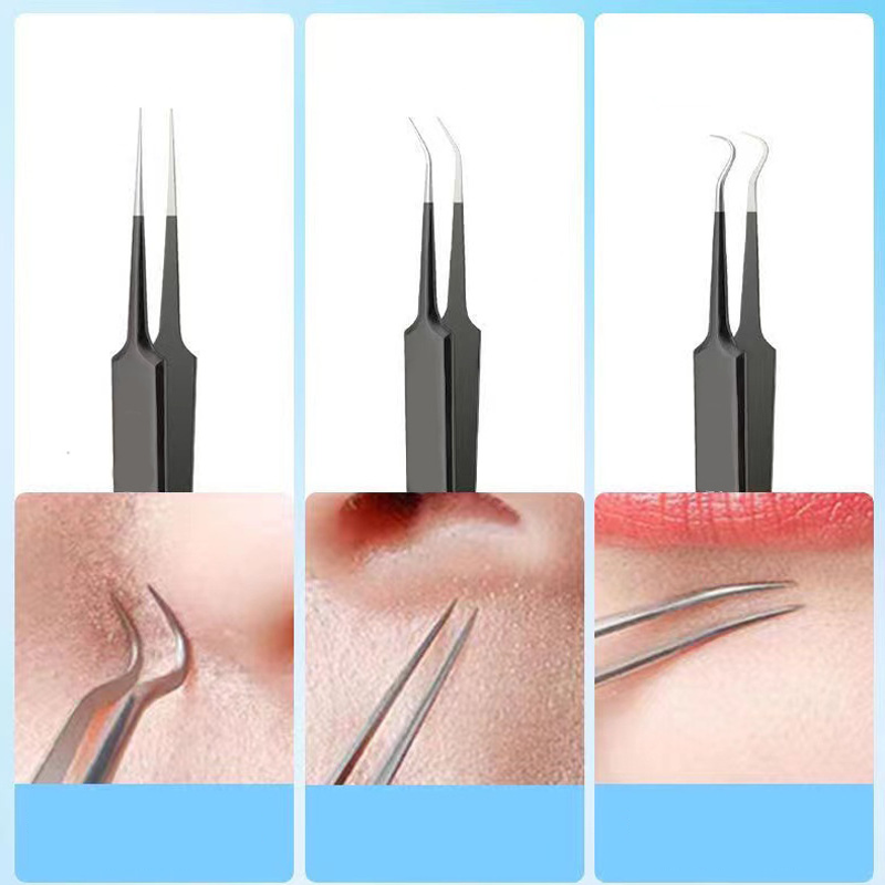 4/6PCS Gesicht Reinigung Kit P – Luxury Skincare Acne Bewertung und Preis