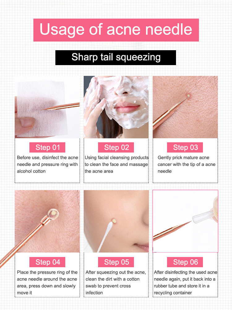 Mitesser-Entferner, Pickel-Kom – Luxury Skincare Acne Bewertung und Preis