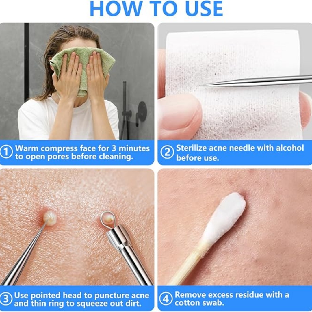 5-teiliges Mitesser-Entferner- – Luxury Skincare Acne Bewertung und Preis