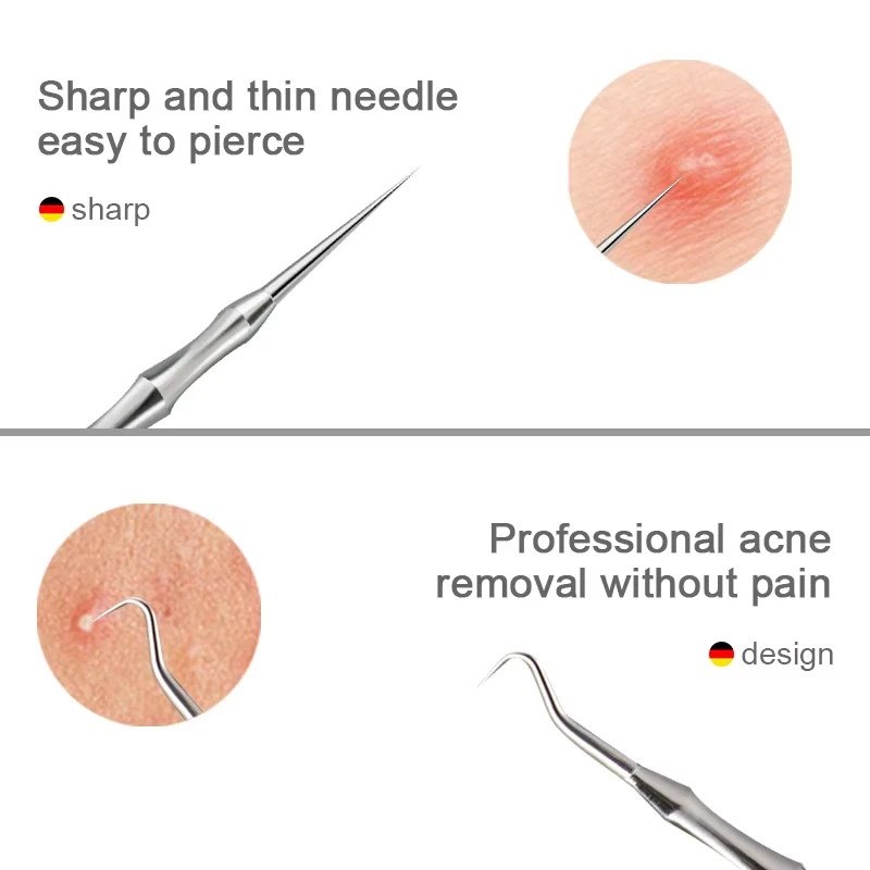 Neues Deutsches Blackhead-Entf – Luxury Skincare Acne Bewertung und Preis